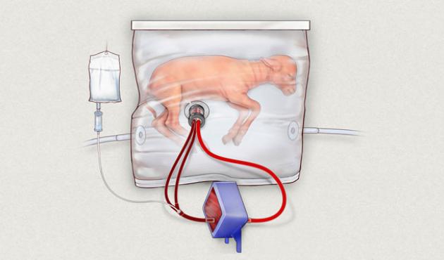 Amerikanske forskere fra Childrens Hospital of Philidelphia lavede for tre år siden en kunstig livmoder som blev testet på lam. Illustration: AP/Ritzau Scanpix